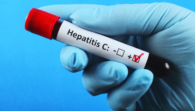 Программа лечения гепатита С стартует в Центре СПИДа